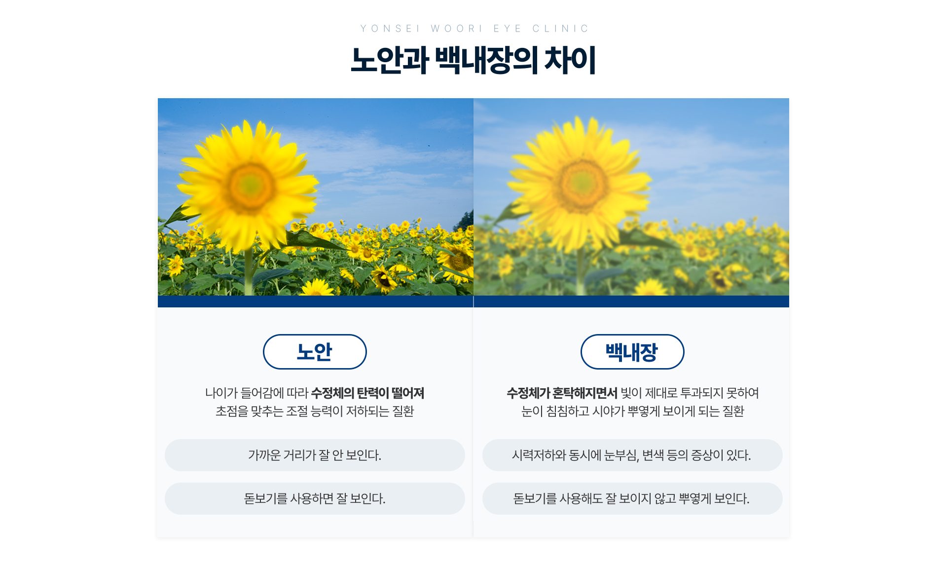 노안과 백내장의 차이 — 기존 설명 그림